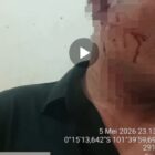 Foto: Bukti luka korban dalam kasus pengeroyokan di Kuantan Singingi