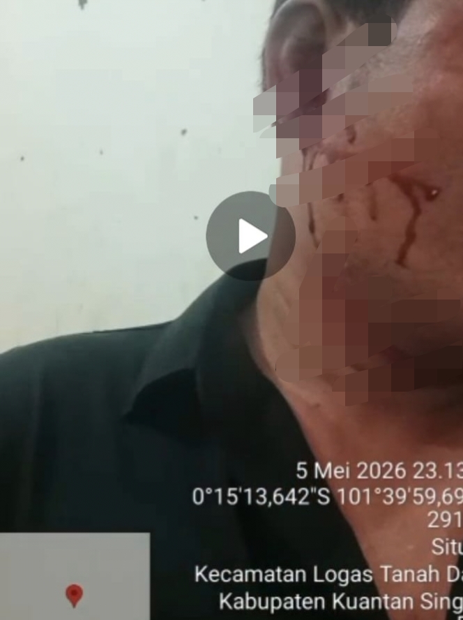 Foto: Bukti luka korban dalam kasus pengeroyokan di Kuantan Singingi